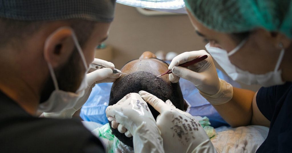 hair-transplant-7518352_1280
